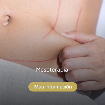 Mesoterapia Roquetas de Mar Almería