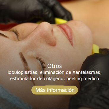 Otros tratamientos faciales