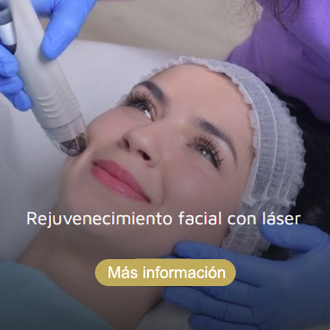 Rejuvenecimiento facial Roquetas de Mar Almería