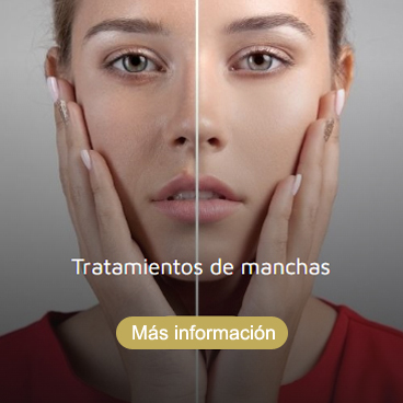 Tratamiento de manchas Roquetas de Mar Almería
