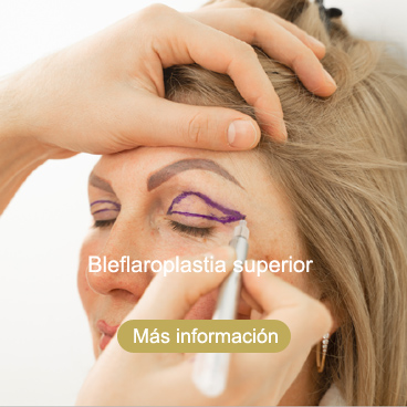 bleflaroplastia superior Roquetas de Mar Almería
