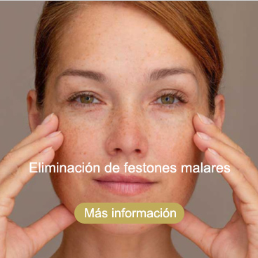 eliminación de festones malares Roquetas de Mar Almería