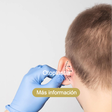 otoplastia Roquetas de Mar Almería